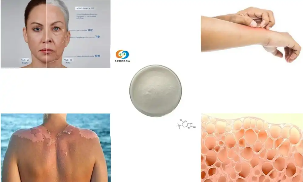 How does L-ergothioneine compare to vitamin E?